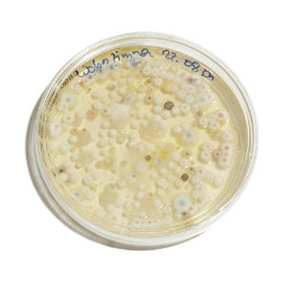 petri dish